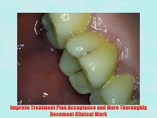 2013 New 5.0 MP USB Intraoral Oral Dental Camera HK790+Pedal with CE FDA Approved