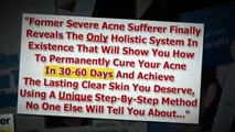 Buy Acne No More - Natural Home Remedies For Acne Scars REVIEWS