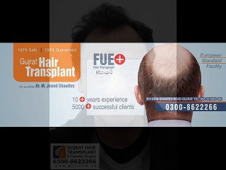 The best top quality FUE Hair Transplant in Pakistan