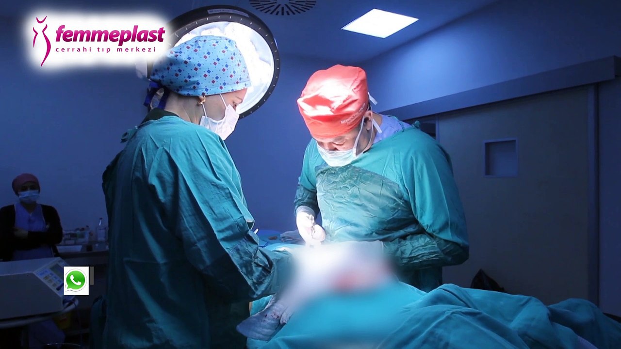 Karın germe sonrası nelere dikkat edilmelidir - Karın Germe Ameliyatı