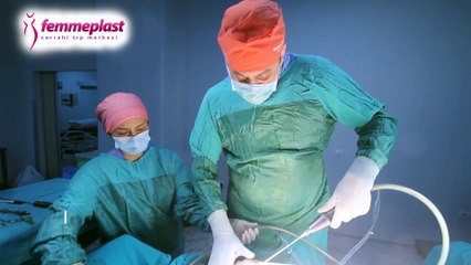 Liposuction sonrası kişi neyle karşılaşır - Liposuction Yöntemi