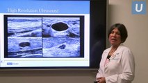 Breast Imaging for Screening and Diagnosis - Nanette DeBruhl, MD | #UCLAMDChat Webinar