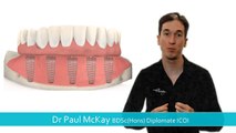 How do Dental Implants, ‘Teeth on Implants’ work?