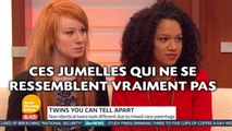 Ces jumelles qui ne se ressemblent vraiment pas