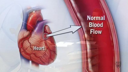 Preventive Cardiology Clinic - Mayo Clinic
