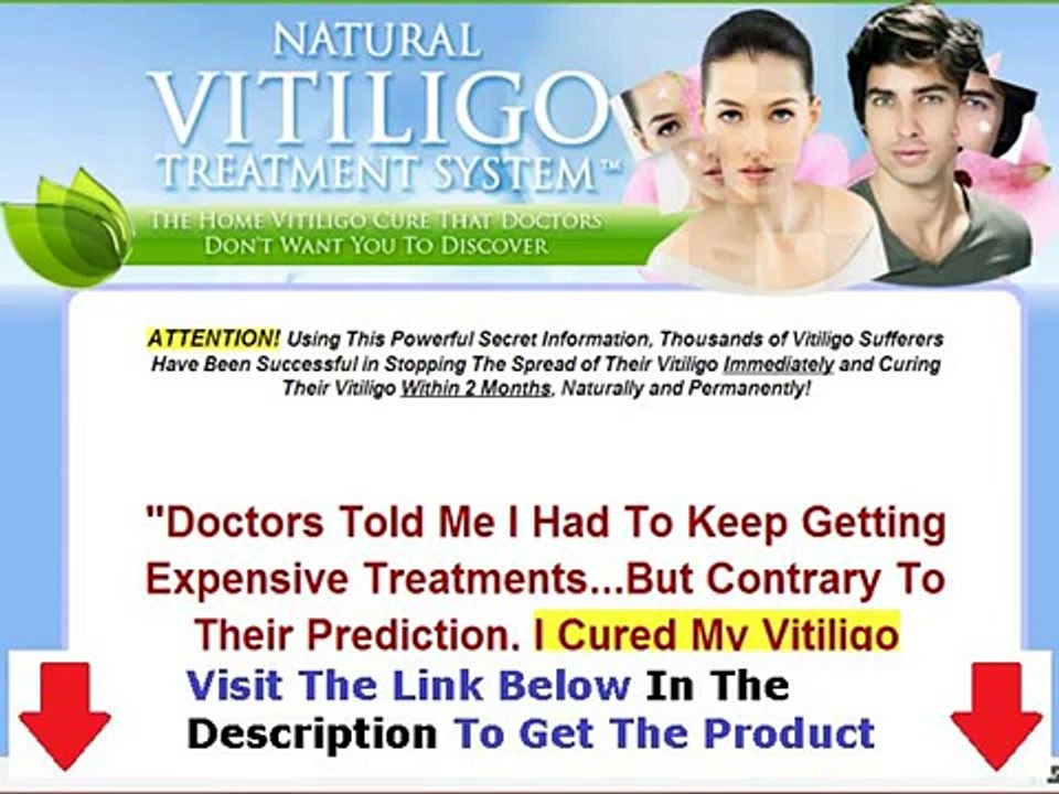 Natural Vitiligo Treatment System FACTS REVEALED Bonus + Discount