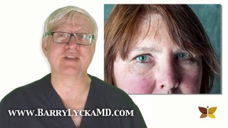 Rosacea - What Causes Rosacea explained by Dr Barry Lycka