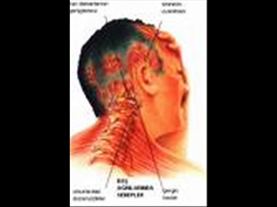 migrentedavisi cgf serumu, cgf yenileme aşısı ile migren tedavisi,migren tedavisi,migren nedir,migrene neler iyi gelir,migrene ne iyi gelir uzmantv migrene ne iyi gelir ibrahim Saraçoğlu,migrene kesin çözüm,migrene iyi gelen bitkiler,migren ağrısı