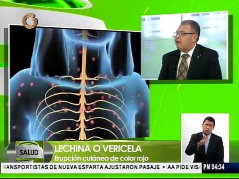 La varicela es una enfermedad benigna y poco frecuente en adultos