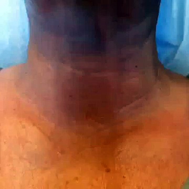 Tighten Your Neck Using Your Body’s Own Natural Healing Processes