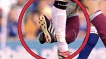 MOST GRUESOME SPORTS INJURIES OF ALL TIME