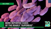 Superbug spreads: Antibiotic resistant bacteria infected 4 patients at UCLA Hospital