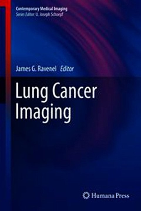 Download Lung Cancer Imaging ebook {PDF} {EPUB}