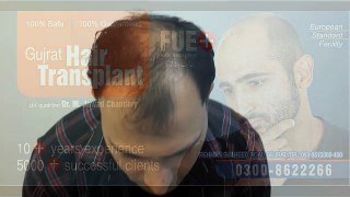 Hair transplant Clinic in Pakistan doing FUE hair transplant