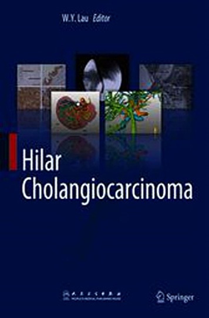 Download Hilar Cholangiocarcinoma ebook {PDF} {EPUB}