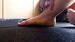 Foot intrinsic strengthening exercises for those with plantar fasciitis