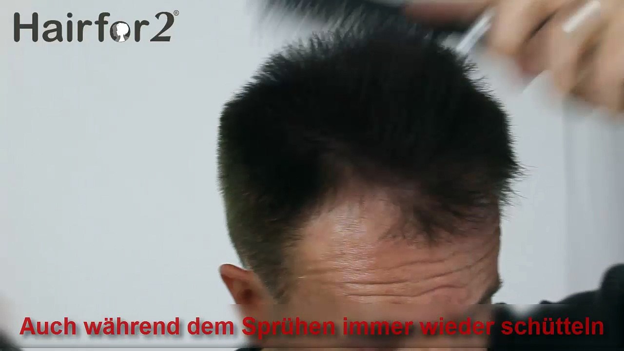 Hairfor2 Selbstanwendung Geheimratsecken