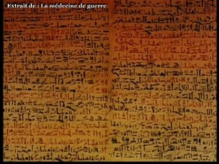 La médecine depuis l'Antiquité