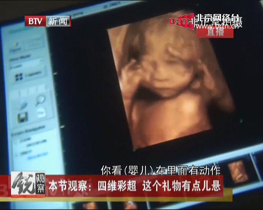 20150309 锐观察 2015-03-09