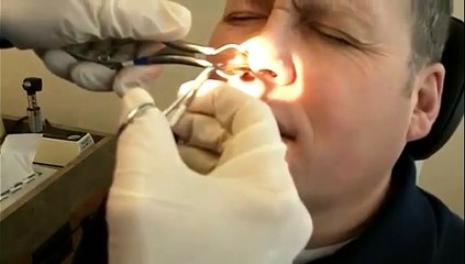 On lui tire les verres du nez. BEURK!!!