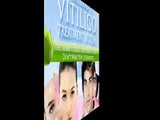 Natural Vitiligo Treatment System Cure Your Vitiligo Naturally, Safely and Permanently