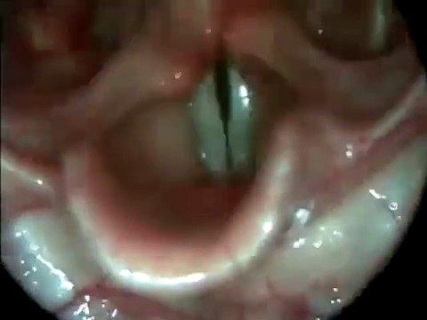 Voici des cordes vocales en action !!!