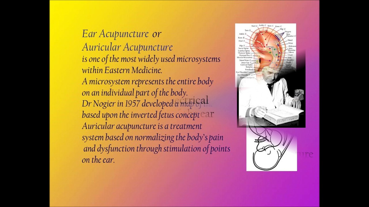 Ear Acupuncture
