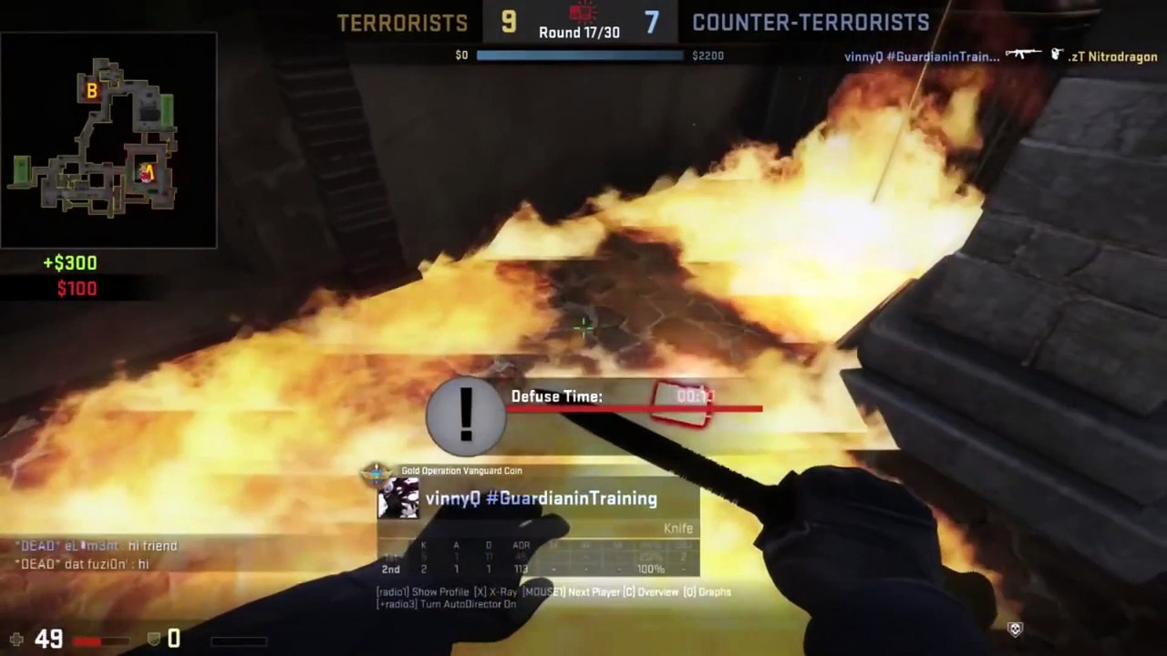 Top 5 fail & fun CSGO #1