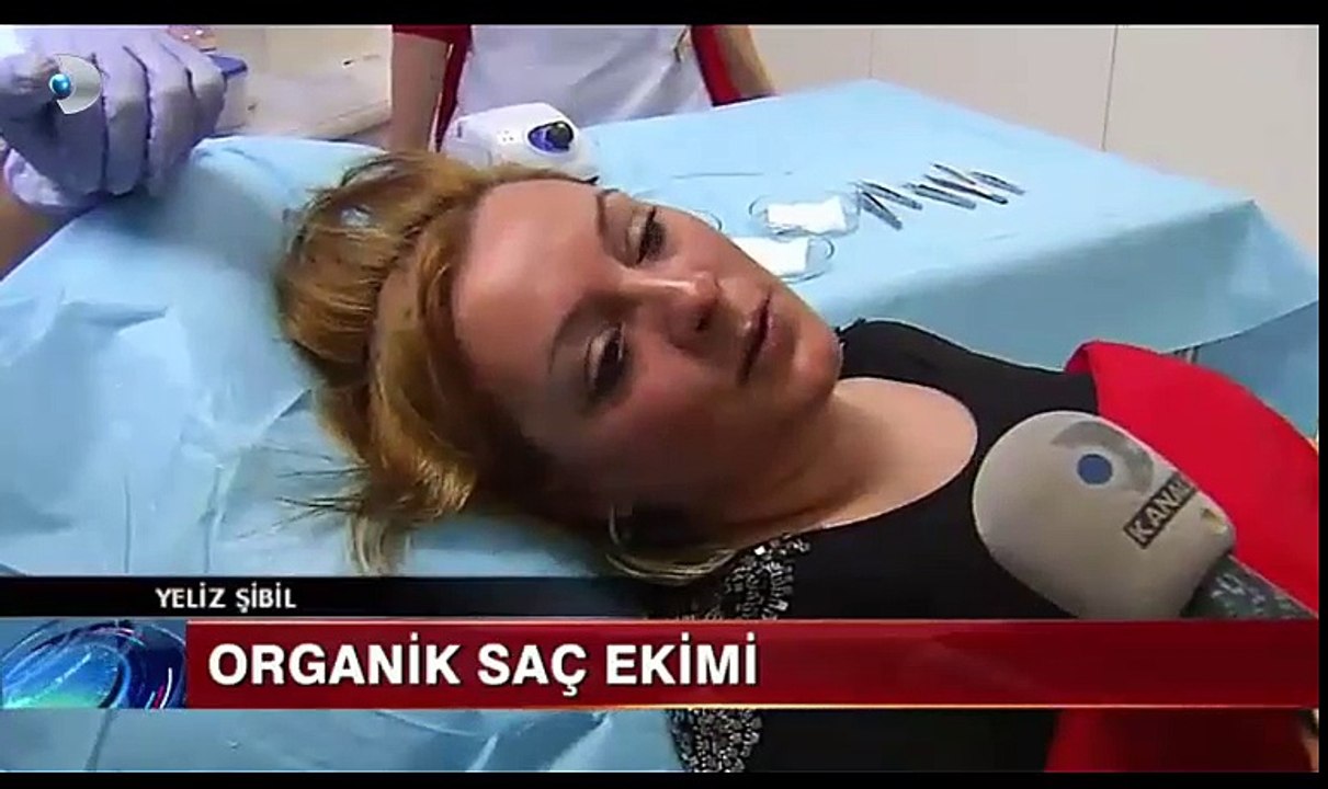 Organik Saç Ekimi Kanal D Ana Haber