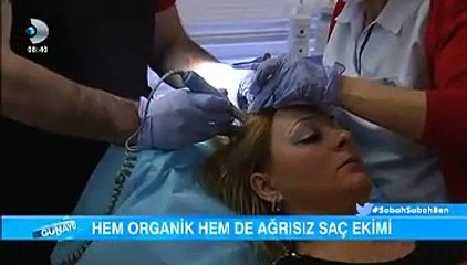 İrfan Değirmenci Kanal D Organik Saç Ekimi