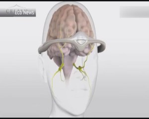 Le Cefaly, l'appareil de traitement des migraines" made in Belgium", commercialisé en Asie