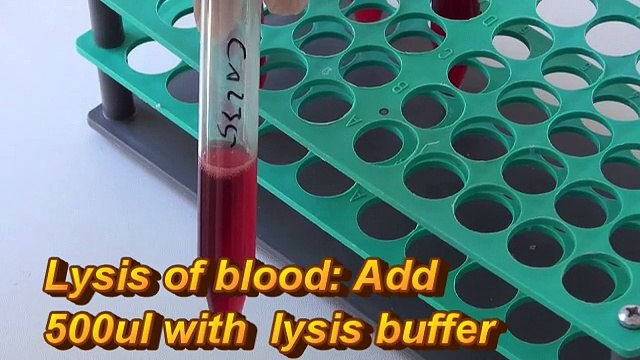 Genekam-magnetic-RNA-isolation from blood for cancer, influenza (H5N1, swine flu), hcv genotyping, HIV, PCR kit detection