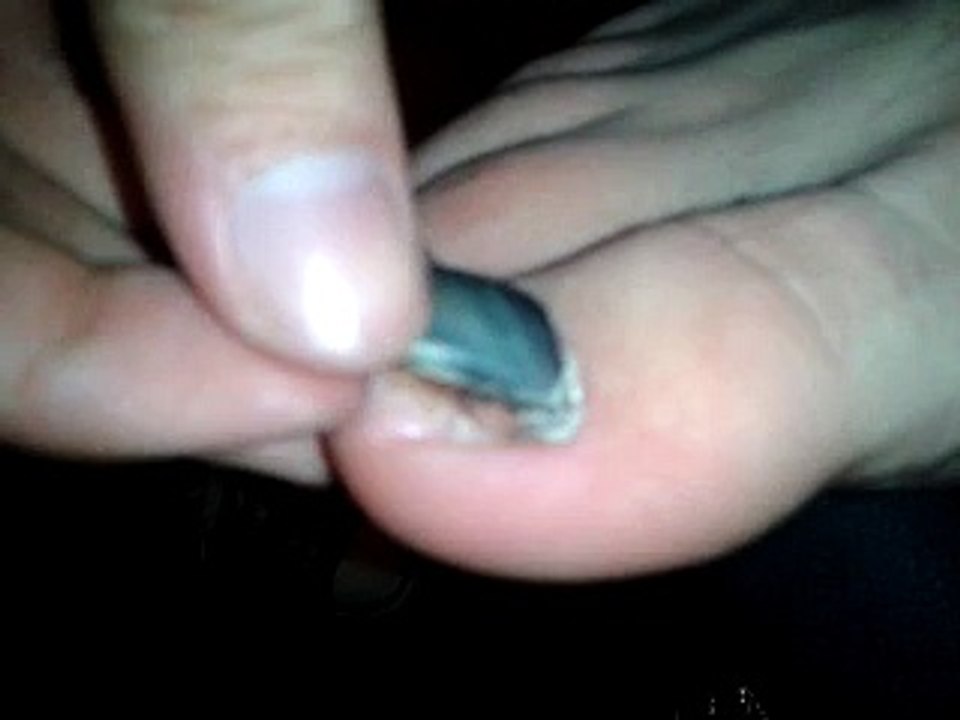 Uñita