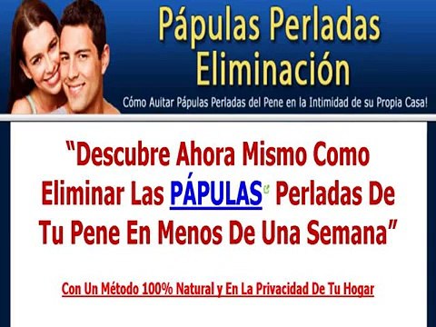 Papulas Perladas Eliminacion!