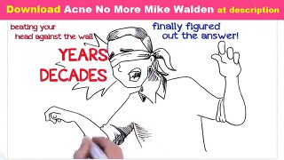 Acne No More REVIEW   Mike Walden!!