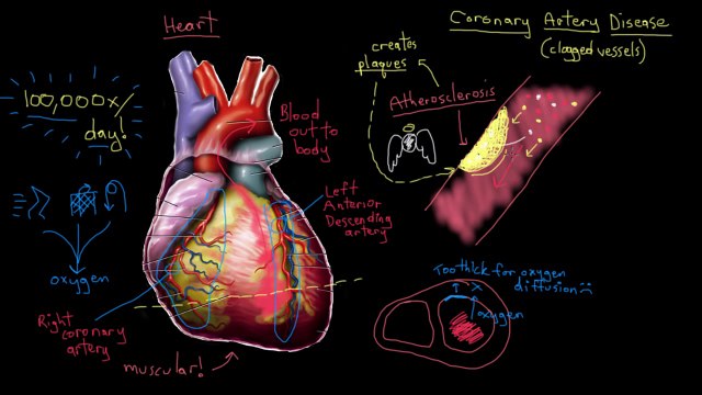 Khan Academy - What is Coronary Artery Disease?