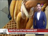 Ekmekten çıkan jilet yemek borusunu parçaladı kalp damarını kesti