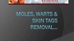 Moles, Warts & Skin Tags Removal System works on ALL types of Moles, Warts & Skin Tags