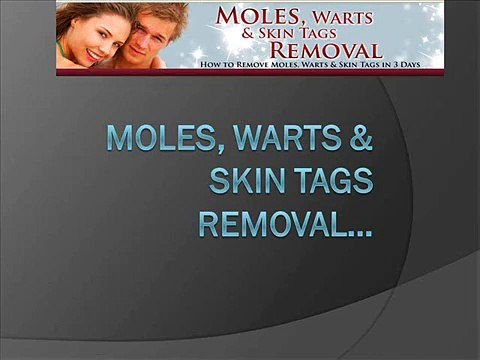 Moles, Warts & Skin Tags Removal System works on ALL types of Moles, Warts & Skin Tags
