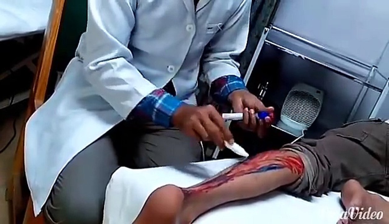 The Thompson test examines the integrity of the Achilles tendon By Dr. HASSAN ANJUM SHAHID PT