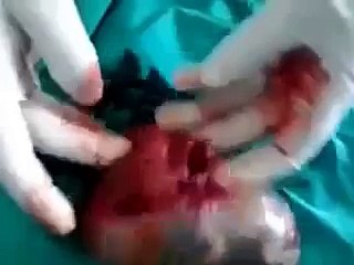 Его убили, а он ещё живой