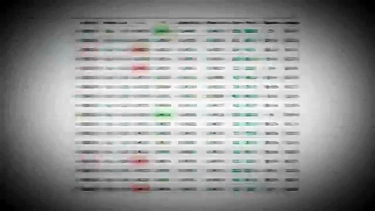 Forex Striker patented robot