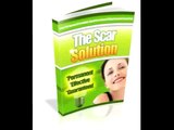 The Scar Solution Review   How To Get Rid Of Scars On Legs   How To Get Rid Of Stretch Marks
