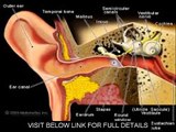 Tinnitus Natural Cure   Tinnitus Miracle Review Guide