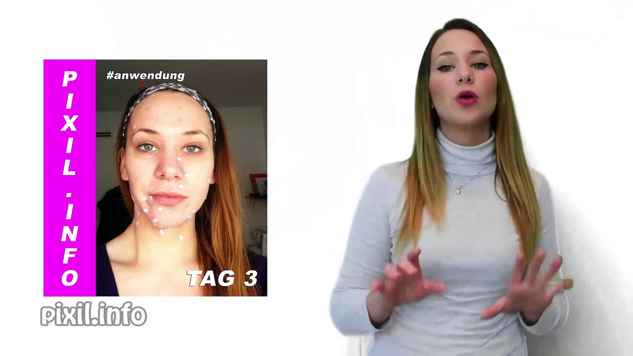 Zinksalbe hilft gegen Pickel & Akne!