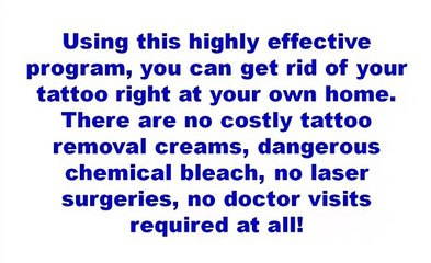 remove tattoo from home - Get Rid Tattoo