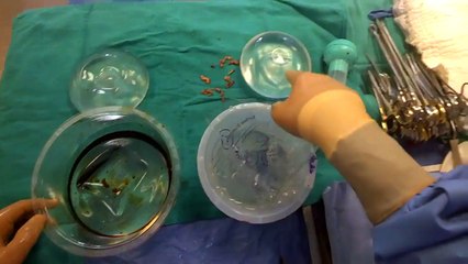 Explains The Keller Funnel Technique [Dr. Johnny Franco] 18+