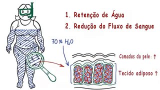 Celulite - Descubra como Eliminar Celulite