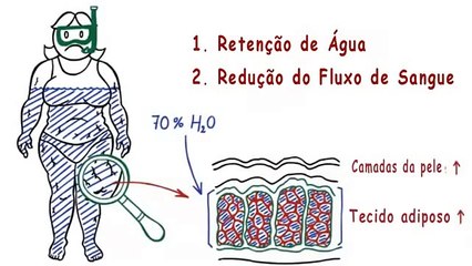 Celulite - Descubra como Eliminar Celulite