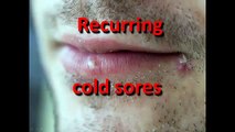 how to get rid of cold sores fast on lips